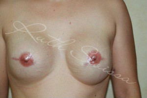 nipple tattoo areola nipple tattoo 3d areola 3d nipple temporary areola tattoo nipple tattoo mastectomy breast cancer awareness